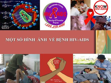 Bài giảng Ngữ văn Lớp 12 - Thông điệp nhân ngày thế giưới phòng chống AIDS 1/12/2003 (Cô-phi An-nan)